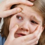 여름철 결막염 섬네일