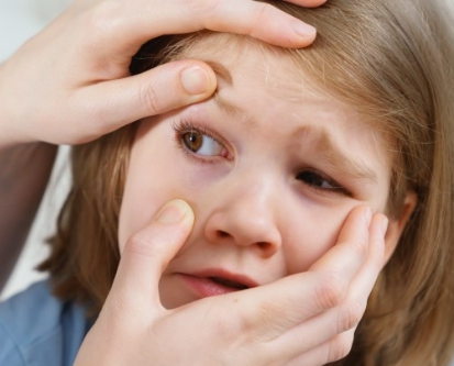 여름철 결막염 섬네일