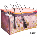 모낭 확대 사진